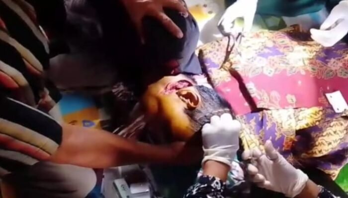 Diduga Dipicu Masalah Sengketa Batas Lahan Tewas Dibacok Sepupu Sendiri