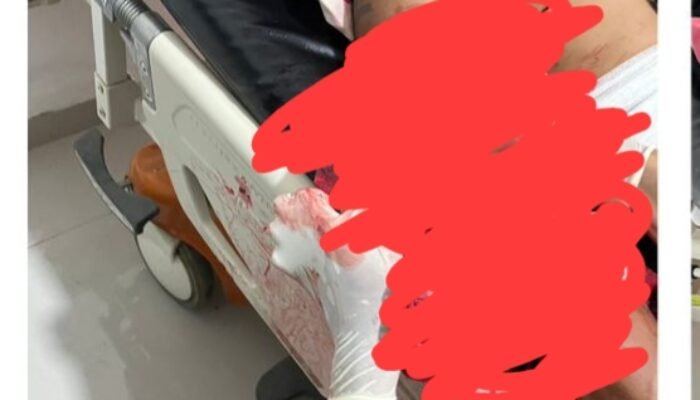 Tiga Pelaku OTD Serang Warga di Simpang Ketuay, Polres OKU Selatan Lakukan Pengejaran