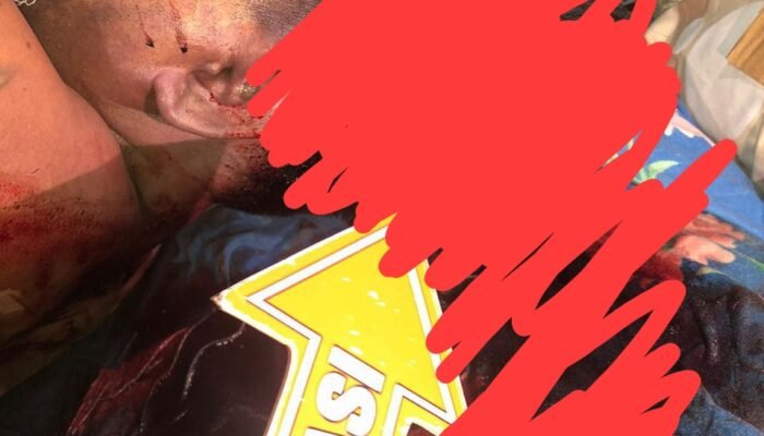 Keributan di Diskotik Palembang Berujung Maut, Satu Korban Tewas Akibat Luka Tusuk di Kepala