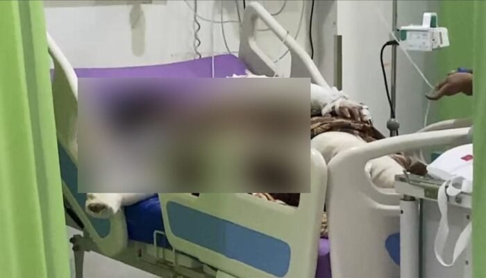 Korban Meninggal Tabrakan Bus Als Vs Truk Tangki BBM Bertambah Jadi 19 Orang
